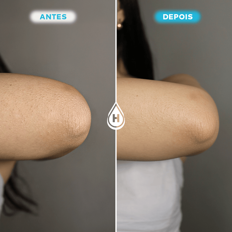 Loção Hidratante Corporal 200ml